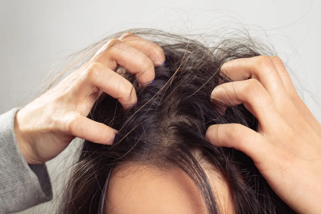 Sticky and itchy scalp